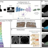 Study overview. (A) Volumetric segmentation of the paraspinal musculature was performed for 1,316 participants. (B) Manual segmentation was performed, the results were compared with the volumetric segmentation results, and the Dice score and the intersection over union were calculated. (C) The three-dimensional segmentations from T1 through T10 were individually extracted and combined into a single volume for analyses. (D) Muscle volume and median muscle attenuation were derived from the segmentation volumes. (E) Analyses were performed to assess the correlation of the paraspinal muscle attenuation and volume with the bone mineral density and the ability to predict vertebral fractures. NIFTI = Neuroimaging Informatics Technology Initiative, 3D = three-dimensional.