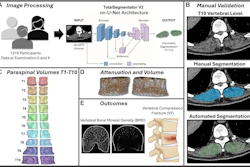 Study overview. (A) Volumetric segmentation of the paraspinal musculature was performed for 1,316 participants. (B) Manual segmentation was performed, the results were compared with the volumetric segmentation results, and the Dice score and the intersection over union were calculated. (C) The three-dimensional segmentations from T1 through T10 were individually extracted and combined into a single volume for analyses. (D) Muscle volume and median muscle attenuation were derived from the segmentation volumes. (E) Analyses were performed to assess the correlation of the paraspinal muscle attenuation and volume with the bone mineral density and the ability to predict vertebral fractures. NIFTI = Neuroimaging Informatics Technology Initiative, 3D = three-dimensional.