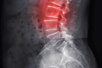 Lumbar Spine
