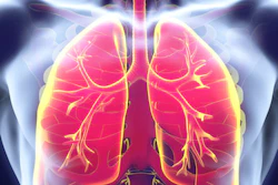 Lungs Red 400