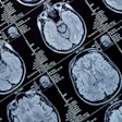 Mri Brain Head 400