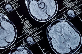 Mri Brain Head 400