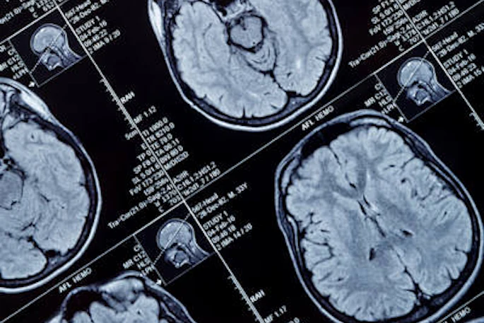 Mri Brain Head 400