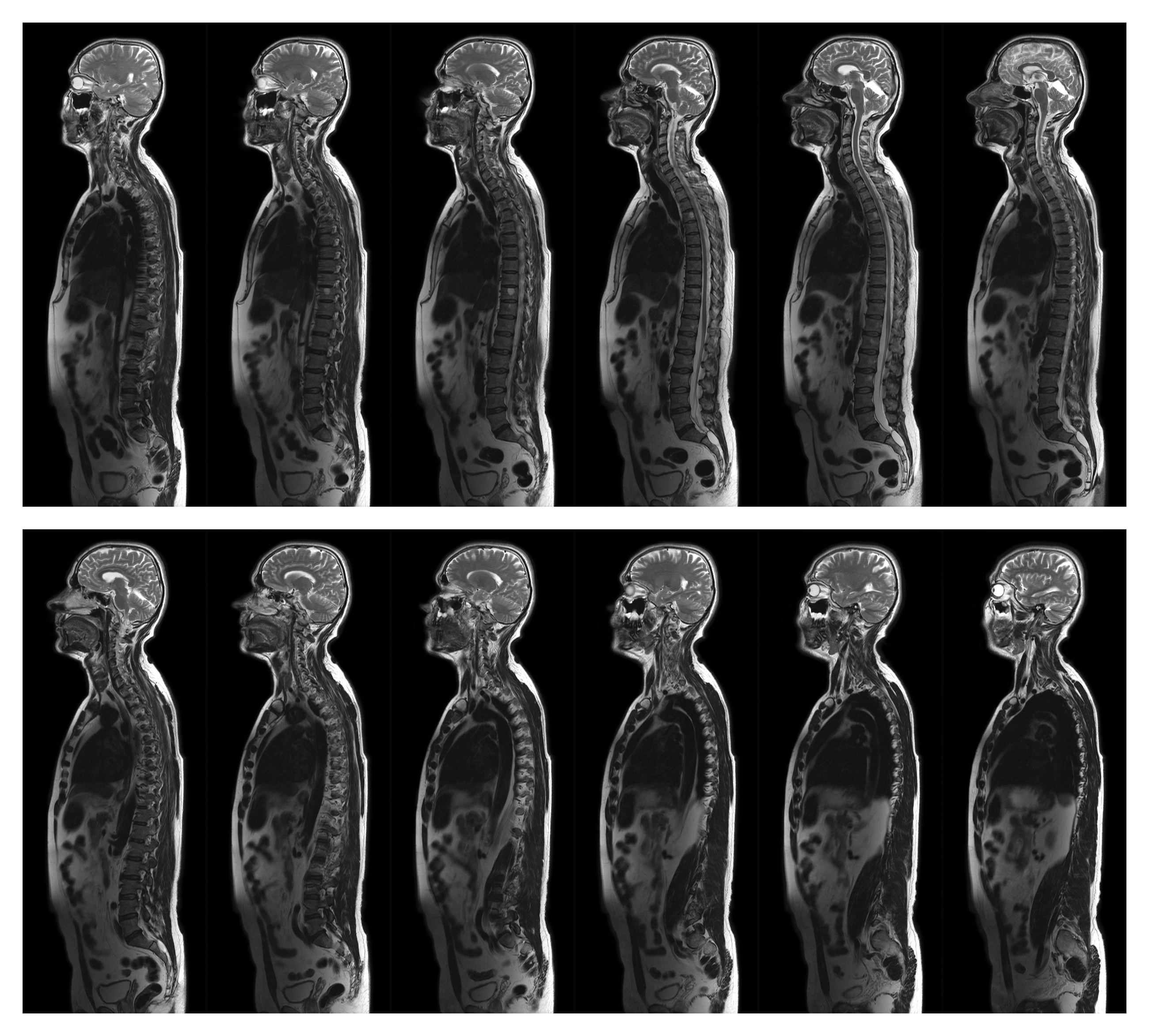 Mri Scan Complete
