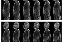 Mri Scan Complete