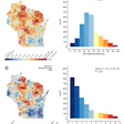 National and state neighborhood-level disadvantage rankings of the study patients. (A) National disadvantage rankings are shown. Left: area deprivation scores mapped onto the state of Wisconsin, where the study sample resides, with national ranking deciles shown. Blue indicates less disadvantaged neighborhoods, whereas red indicates more disadvantaged neighborhoods. Right: histogram quantifying the number of patients in each Area Deprivation Index (ADI) decile. (B) Same as A, but state ranking deciles are shown. The distributions of both the national and state-level ADI rankings of the patients were skewed toward less disadvantaged neighborhoods. Maps were obtained from reference 36.