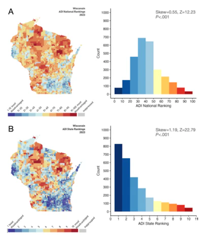 National and state neighborhood-level disadvantage rankings of the study patients. (A) National disadvantage rankings are shown. Left: area deprivation scores mapped onto the state of Wisconsin, where the study sample resides, with national ranking deciles shown. Blue indicates less disadvantaged neighborhoods, whereas red indicates more disadvantaged neighborhoods. Right: histogram quantifying the number of patients in each Area Deprivation Index (ADI) decile. (B) Same as A, but state ranking deciles are shown. The distributions of both the national and state-level ADI rankings of the patients were skewed toward less disadvantaged neighborhoods. Maps were obtained from reference 36.