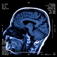Structural Mri