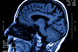 Structural Mri