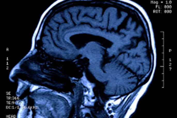 Structural Mri