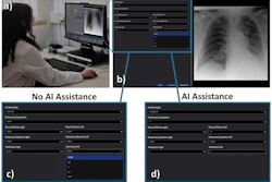 Radiologist comparing chest X-ray analysis with and without AI assistance using medical imaging software