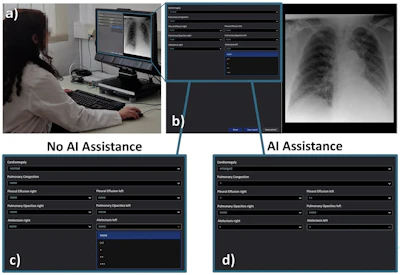 AI fails to compensate for night-shift fatigue among residents