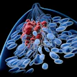 3D medical illustration of a lymph node with red immune cells and blue lymphocytes against black background
