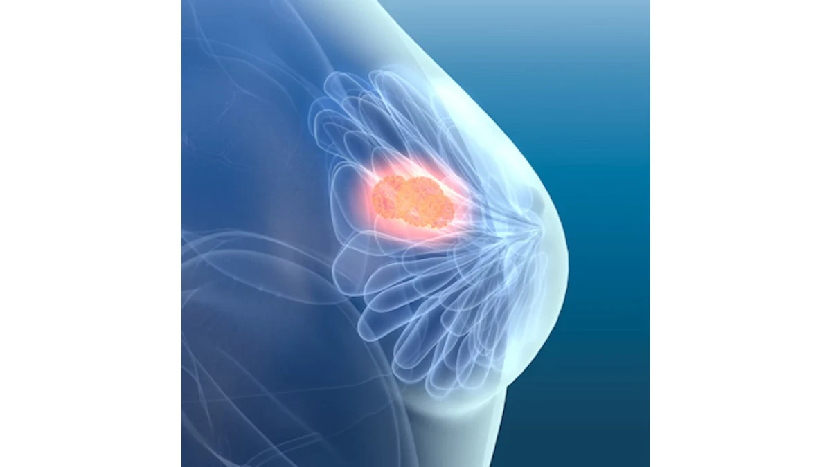Visualizer Software Hue FDA clears SimBioSys's breast cancer risk software | AuntMinnie