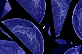 Collection of mammography breast scan images displayed on black background for medical diagnostic review