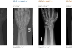 Four wrist X-ray images showing fracture detection examples: true positive with distal radius fracture, true negative normal wrist, false positive misidentified fracture, and false negative missed fracture.