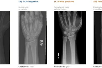 Four wrist X-ray images showing fracture detection examples: true positive with distal radius fracture, true negative normal wrist, false positive misidentified fracture, and false negative missed fracture.