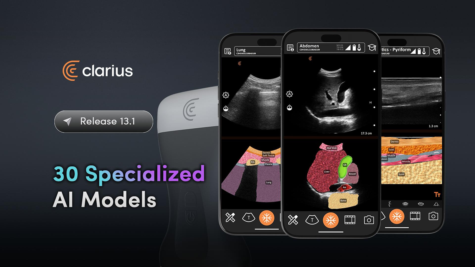 Clarius Release 13.1 ultrasound software with 30 specialized AI models for medical imaging