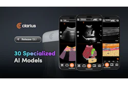 Clarius Release 13.1 ultrasound software with 30 specialized AI models for medical imaging