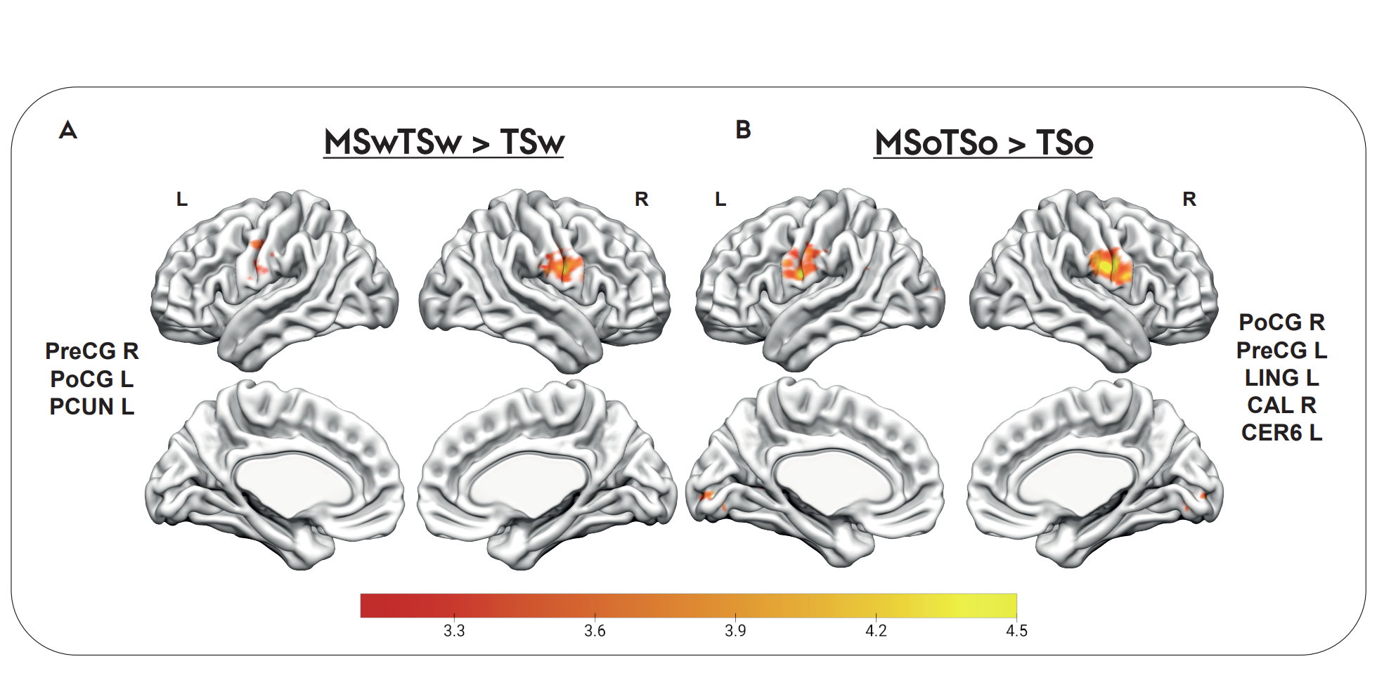 Brain fMRI activation maps showing statistical comparisons of temporal-spatial processing regions with color-coded intensity scales