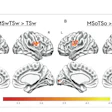 Brain fMRI activation maps showing statistical comparisons of temporal-spatial processing regions with color-coded intensity scales