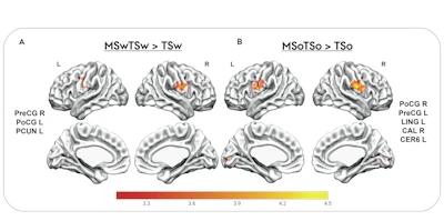 fMRI reveals how music enhances food taste