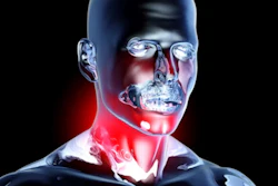 3D medical illustration of human head and neck showing inflammation in red, highlighting throat and jaw anatomy