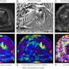 MRI elastography imaging panel showing magnitude, phase, and elastogram data with heat map visualizations for tissue stiffness analysis