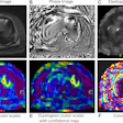 MRI elastography imaging panel showing magnitude, phase, and elastogram data with heat map visualizations for tissue stiffness analysis