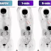 PET scan comparison showing SAFOV baseline and 1-minute and 5-minute time-point imaging with tracer uptake patterns
