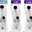 PET scan comparison showing SAFOV baseline and 1-minute and 5-minute time-point imaging with tracer uptake patterns