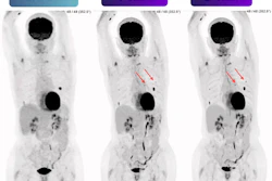 PET scan comparison showing SAFOV baseline and 1-minute and 5-minute time-point imaging with tracer uptake patterns