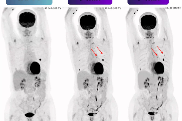PET scan comparison showing SAFOV baseline and 1-minute and 5-minute time-point imaging with tracer uptake patterns