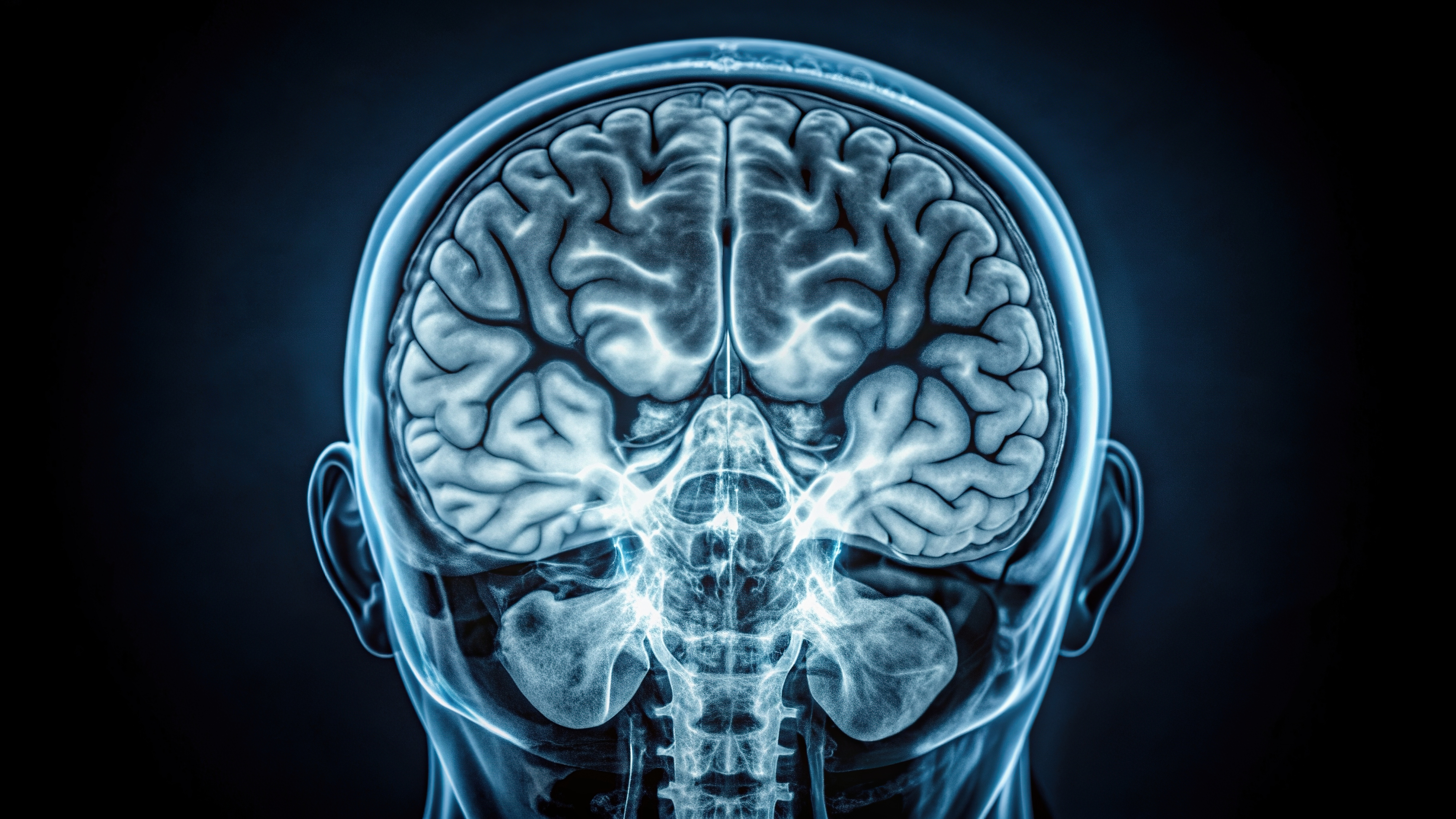 Coronal MRI scan of human brain showing cerebral hemispheres and brainstem structures in blue-toned medical imaging