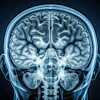 Coronal MRI scan of human brain showing cerebral hemispheres and brainstem structures in blue-toned medical imaging