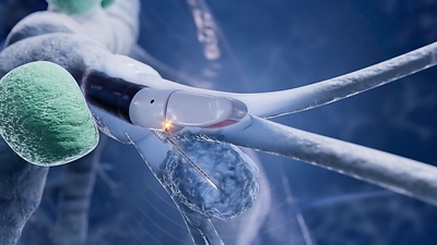 Microscopic view of cells being examined with a pipette needle under laboratory magnification