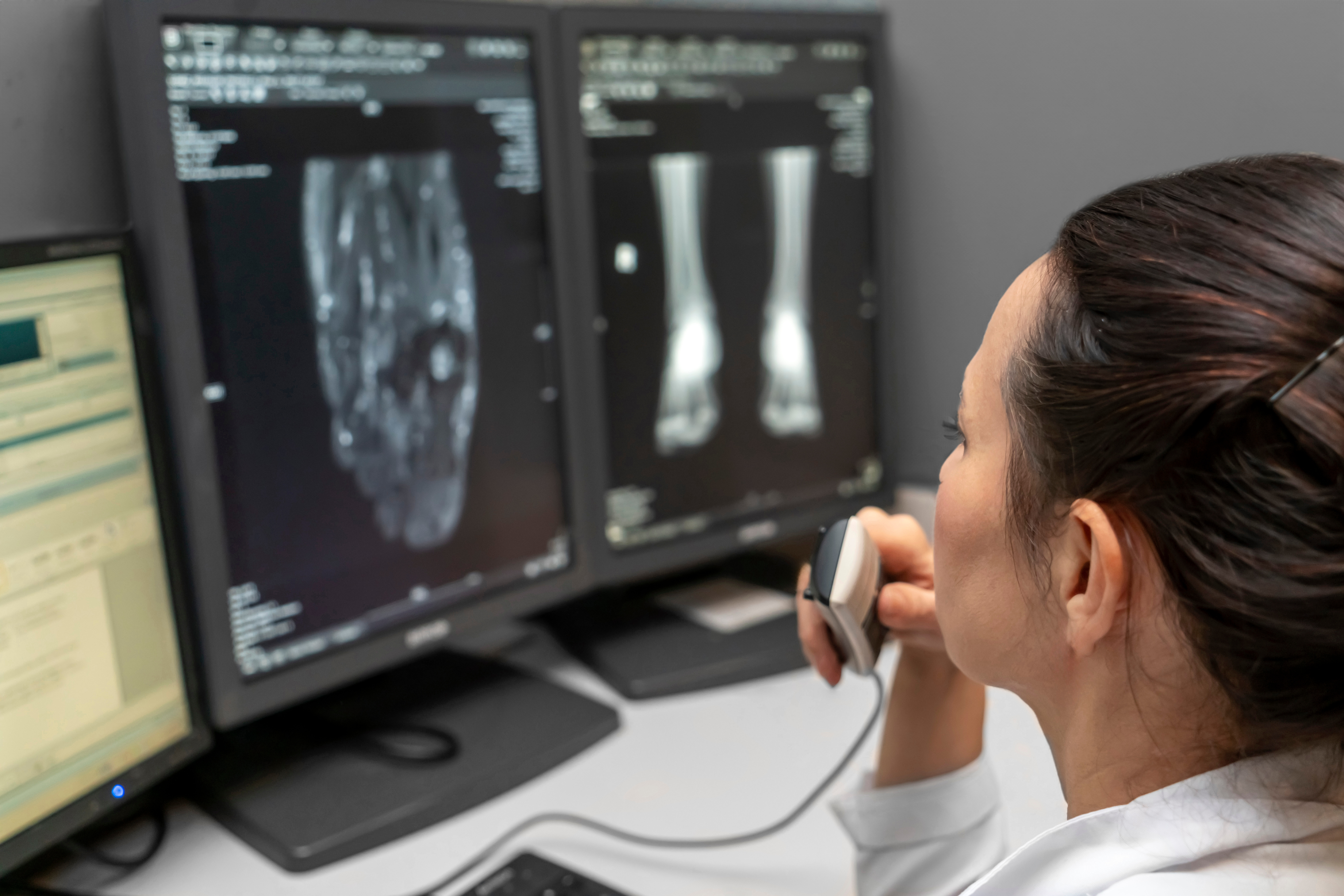 Radiologist reviewing CT and X-ray scans on dual monitors in medical imaging workstation