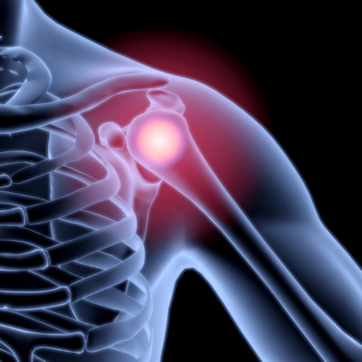 3D medical illustration of shoulder joint pain with glowing red inflammation on skeletal anatomy