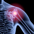 3D medical illustration of shoulder joint pain with glowing red inflammation on skeletal anatomy