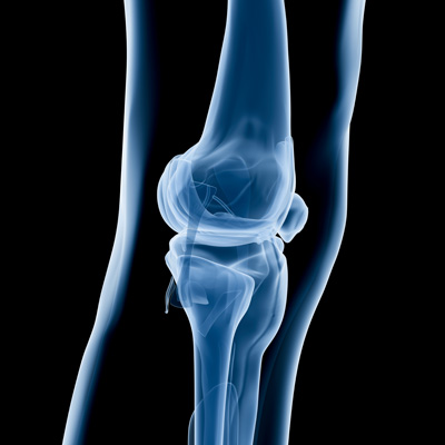 X-ray image of human knee joint showing femur, tibia, fibula, and patella in anteroposterior view
